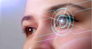 An Overview of Different Types of Laser-Assisted Refractive Procedures: Benefits and Limitations An Overview of Different Types of Laser-Assisted Refractive Procedures: Benefits and Limitations