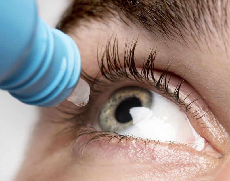Corneal Inlays Corneal Inlays