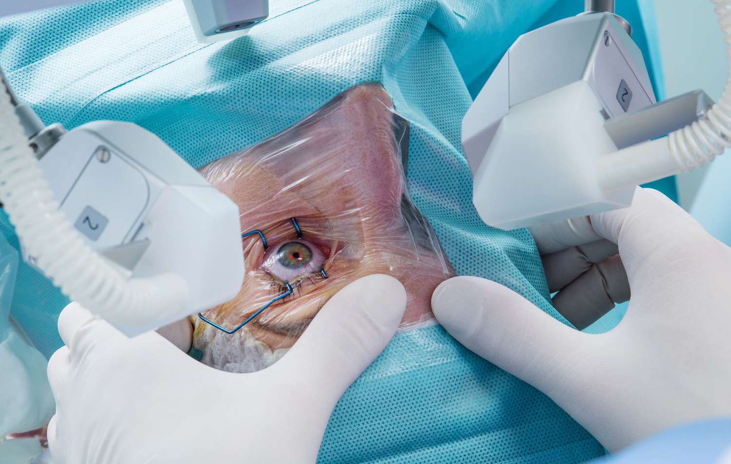 Laser Eye Clinic