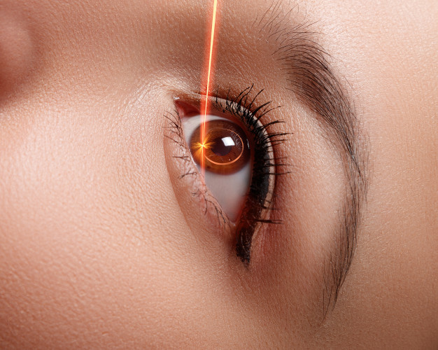 Lasik Refractive Surgery